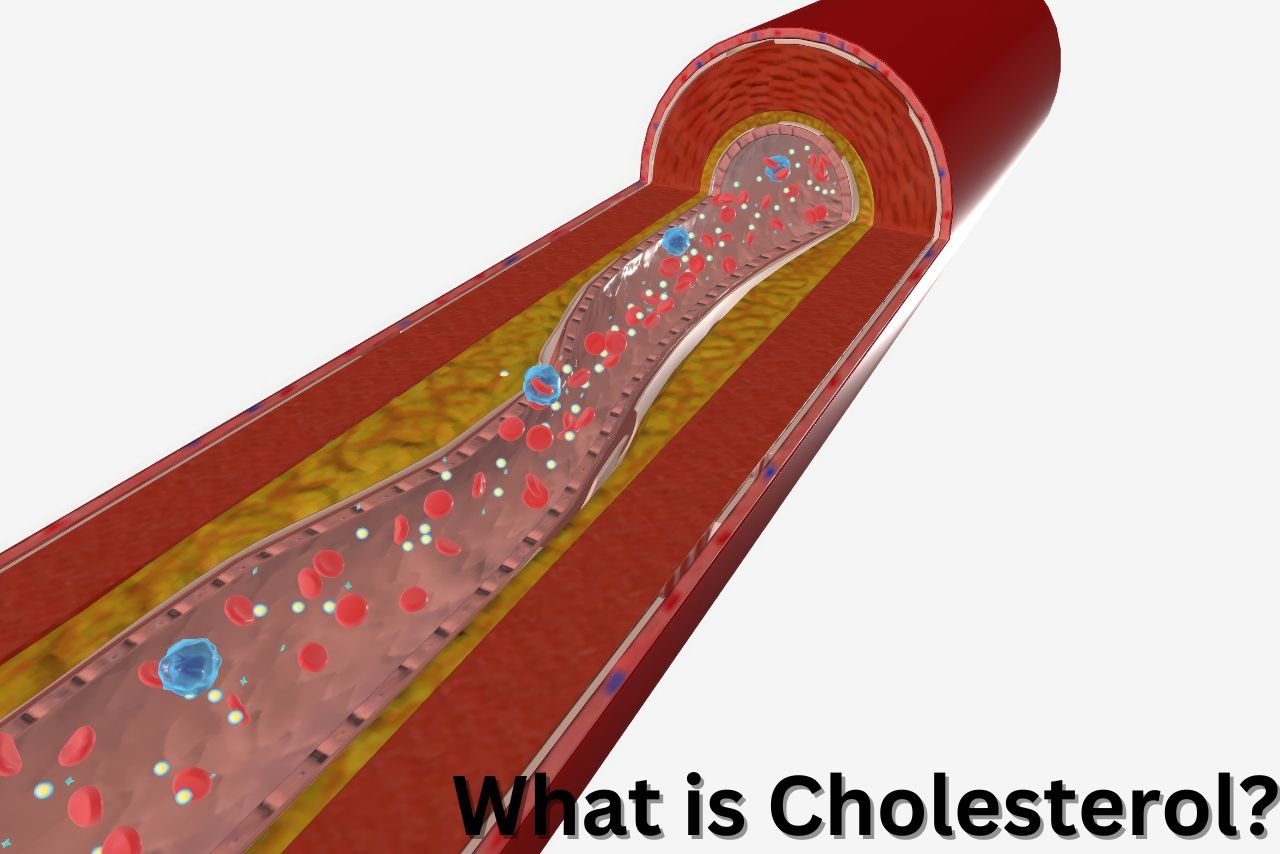 What is Cholesterol? High Cholesterol के लक्षण क्या है?